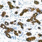 Anti-Cytokeratin 7 (KRT7) Antibody, clone 6Q1B4, Rabbit Monoclonal
