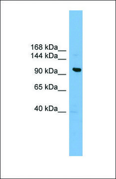Anti-VPS41 antibody produced in rabbit affinity isolated antibody