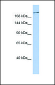 Anti-CACNA1G antibody produced in rabbit affinity isolated antibody