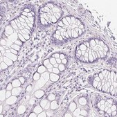 Anti-MYL4 antibody produced in rabbit Prestige Antibodies&#174; Powered by Atlas Antibodies, affinity isolated antibody, buffered aqueous glycerol solution