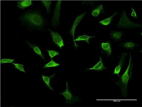 Monoclonal Anti-AMBP antibody produced in mouse clone 4A7, purified immunoglobulin, buffered aqueous solution