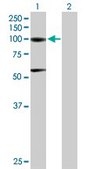 Anti-ACO1 antibody produced in mouse purified immunoglobulin, buffered aqueous solution