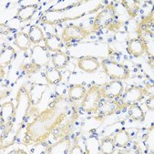 Anti-CTGF antibody produced in rabbit