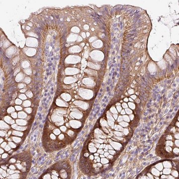 Anti-SOS2 antibody produced in rabbit Prestige Antibodies&#174; Powered by Atlas Antibodies, affinity isolated antibody, buffered aqueous glycerol solution