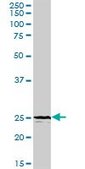 Anti-TREM1 antibody produced in rabbit purified immunoglobulin, buffered aqueous solution