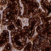 Monoclonal Anti-TG antibody produced in mouse Prestige Antibodies&#174; Powered by Atlas Antibodies, clone CL0164, purified immunoglobulin, buffered aqueous glycerol solution