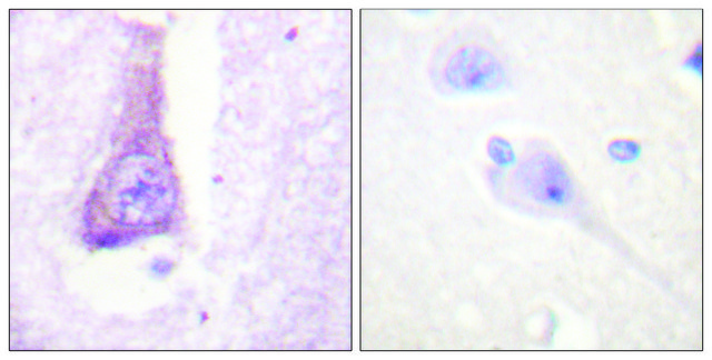 Anti-WASP antibody produced in rabbit affinity isolated antibody