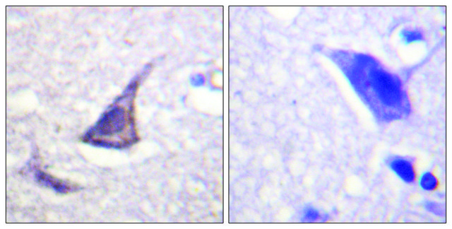 Anti-C/EBP-&#949; antibody produced in rabbit affinity isolated antibody