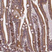 Anti-MTDH antibody produced in rabbit Ab1, Prestige Antibodies&#174; Powered by Atlas Antibodies, affinity isolated antibody, buffered aqueous glycerol solution