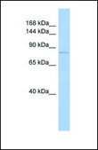 Anti-TRPV4 antibody produced in rabbit affinity isolated antibody