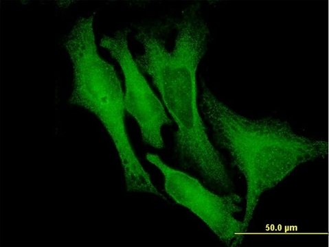 Monoclonal Anti-DCX antibody produced in mouse clone 1G12, purified immunoglobulin, buffered aqueous solution