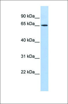 Anti-WT1 antibody produced in rabbit affinity isolated antibody