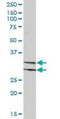Anti-PDXK antibody produced in mouse purified immunoglobulin, buffered aqueous solution