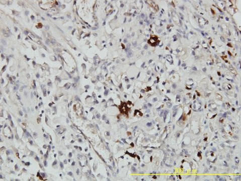 Monoclonal Anti-ORM1 antibody produced in mouse clone 2F9-1F10, purified immunoglobulin, buffered aqueous solution