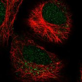 Anti-LRRK2 antibody produced in rabbit Prestige Antibodies&#174; Powered by Atlas Antibodies, affinity isolated antibody, buffered aqueous glycerol solution