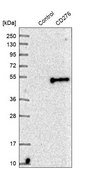 Anti-CD276 antibody produced in rabbit Ab1, Prestige Antibodies&#174; Powered by Atlas Antibodies, affinity isolated antibody, buffered aqueous glycerol solution