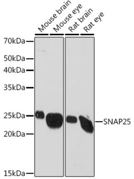 Anti-SNAP25 Antibody, clone 7Y9E3, Rabbit Monoclonal