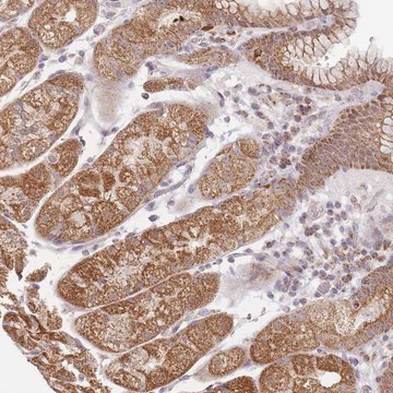 Anti-ESRP2 antibody produced in rabbit Prestige Antibodies&#174; Powered by Atlas Antibodies, affinity isolated antibody, buffered aqueous glycerol solution