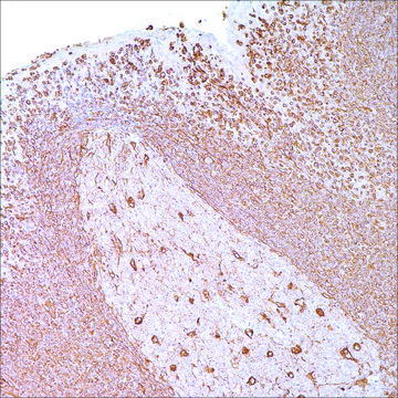 Vimentin (V9) Mouse Monoclonal Antibody