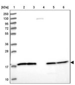 Anti-NDUFB6 antibody produced in rabbit Prestige Antibodies&#174; Powered by Atlas Antibodies, affinity isolated antibody, buffered aqueous glycerol solution