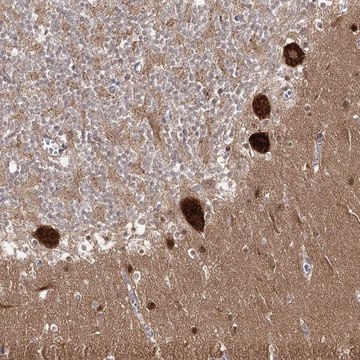 Anti-AP2M1 antibody produced in rabbit Prestige Antibodies&#174; Powered by Atlas Antibodies, affinity isolated antibody, buffered aqueous glycerol solution
