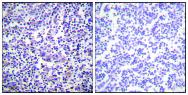 Anti-B-RAF, C-Terminal antibody produced in rabbit affinity isolated antibody