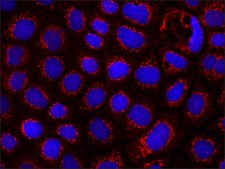 Anti-APC (C-terminal) antibody produced in rabbit ~1.0&#160;mg/mL, affinity isolated antibody