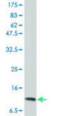 Monoclonal Anti-IL2, (C-terminal) antibody produced in mouse clone 1C5, purified immunoglobulin, buffered aqueous solution