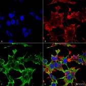Monoclonal Anti-Lrrk2/Dardarin - Rpe antibody produced in mouse clone S138-6, purified immunoglobulin