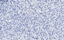 Anti-SSNA1 Antibody, clone 4C4 ZooMAb&#174; Rabbit Monoclonal recombinant, expressed in HEK 293 cells