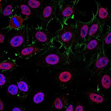 Anti-KAT7 Antibody (HBO1 / MYST2) from rabbit, purified by affinity chromatography