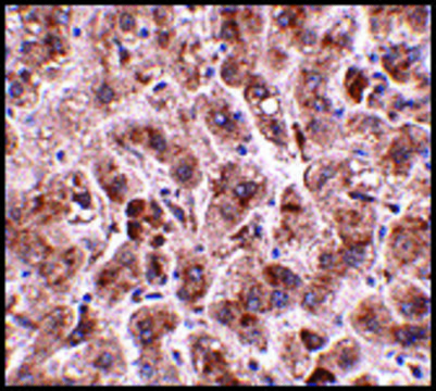 Anti-TREX2 antibody produced in rabbit affinity isolated antibody, buffered aqueous solution