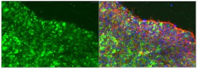Anti-podocalyxin associated keratan sulfate, clone R-10G| MABD151 Antibody clone R-10G, from mouse