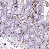 Anti-HLA-DRA antibody produced in rabbit Prestige Antibodies&#174; Powered by Atlas Antibodies, affinity isolated antibody, buffered aqueous glycerol solution