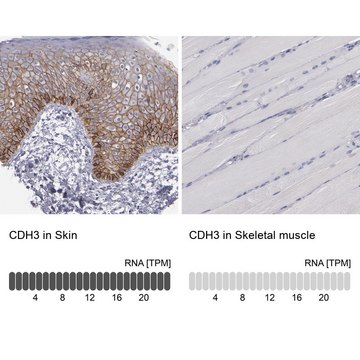 Anti-CDH3 antibody produced in rabbit Prestige Antibodies&#174; Powered by Atlas Antibodies, affinity isolated antibody, buffered aqueous glycerol solution