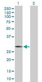Anti-ICOS antibody produced in rabbit purified immunoglobulin, buffered aqueous solution