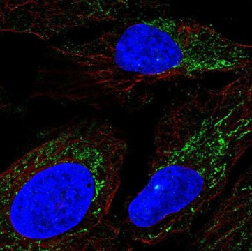 Anti-DMGDH antibody produced in rabbit Prestige Antibodies&#174; Powered by Atlas Antibodies, affinity isolated antibody