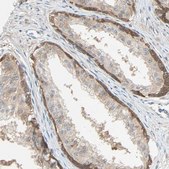 Anti-TNFRSF12A antibody produced in rabbit Prestige Antibodies&#174; Powered by Atlas Antibodies, affinity isolated antibody, buffered aqueous glycerol solution