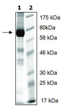 UBE3A active human recombinant, expressed in baculovirus infected Sf9 cells, &#8805;72% (SDS-PAGE)