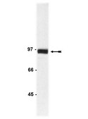 Anti-&#946;-Catenin Antibody Upstate&#174;, from rabbit