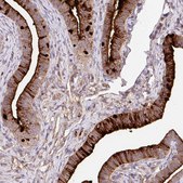 Anti-CRISP3 antibody produced in rabbit Prestige Antibodies&#174; Powered by Atlas Antibodies, affinity isolated antibody, buffered aqueous glycerol solution