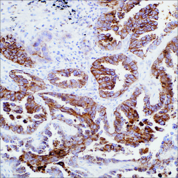 Napsin A (MRQ-60) Mouse Monoclonal Antibody