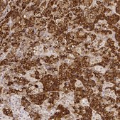 Anti-PRL antibody produced in rabbit Prestige Antibodies&#174; Powered by Atlas Antibodies, affinity isolated antibody