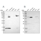 Anti-CRAT antibody produced in rabbit Prestige Antibodies&#174; Powered by Atlas Antibodies, affinity isolated antibody, buffered aqueous glycerol solution, Ab2