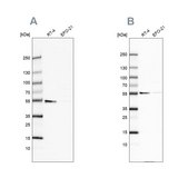 Anti-ATP5A1 antibody produced in rabbit Prestige Antibodies&#174; Powered by Atlas Antibodies, affinity isolated antibody, buffered aqueous glycerol solution