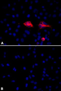 Anti-PLAUR/uPAR antibody, Mouse monoclonal clone PL231, purified from hybridoma cell culture