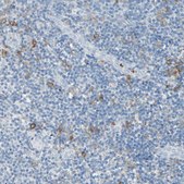 Anti-CLEC4A antibody produced in rabbit Prestige Antibodies&#174; Powered by Atlas Antibodies, affinity isolated antibody, buffered aqueous glycerol solution