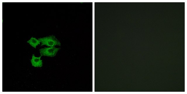 Anti-LY6E antibody produced in rabbit affinity isolated antibody