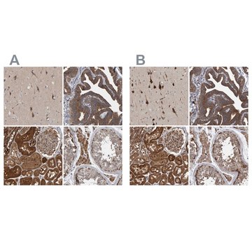 Anti-KIAA0753 antibody produced in rabbit Prestige Antibodies&#174; Powered by Atlas Antibodies, affinity isolated antibody, buffered aqueous glycerol solution, Ab2