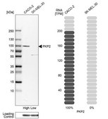 Anti-PKP2 antibody produced in rabbit Prestige Antibodies&#174; Powered by Atlas Antibodies, affinity isolated antibody, buffered aqueous glycerol solution